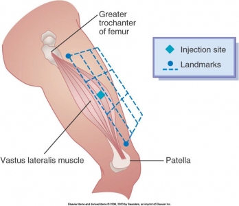 For injection tramadol sites