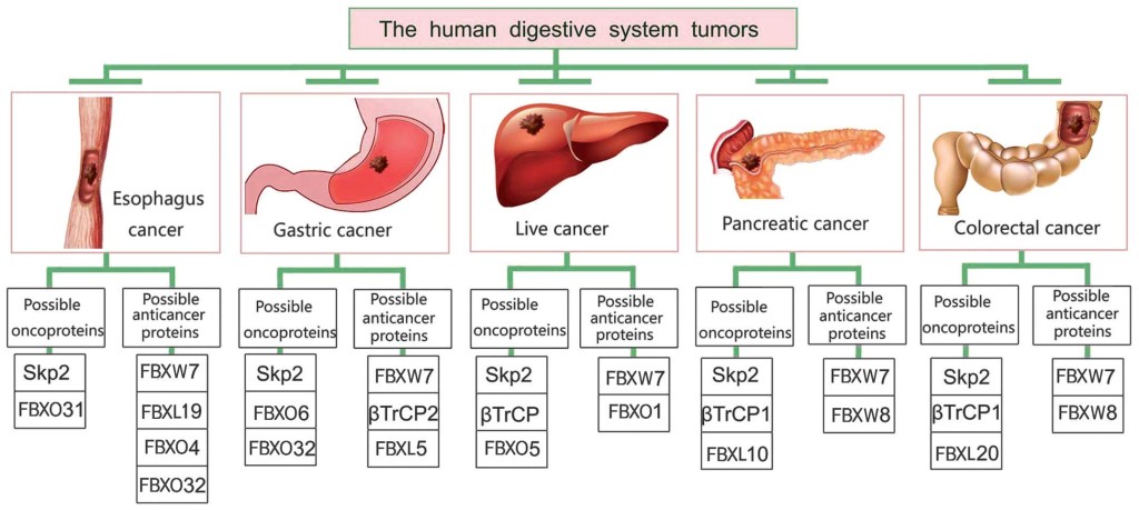 neoplasm